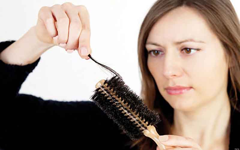 علل ریزش مو در دوران بارداری و جنسیت جنین